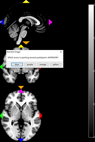 根据上一个选项继续选择前侧.png